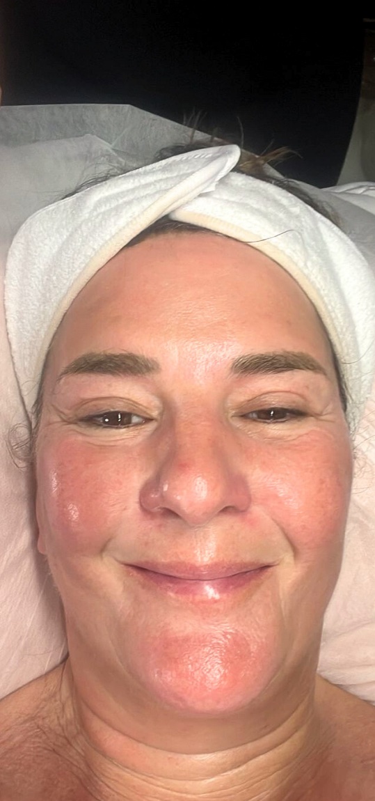 After: the same client after the gua sha ritual, depuffed and glowing
