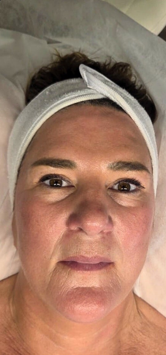 Before: a client's face before a gua sha ritual